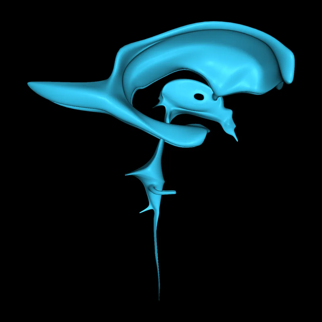 Brain (Ventricles – Isolated), lateral view