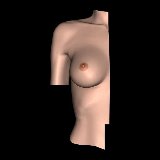 Breast, anterior view