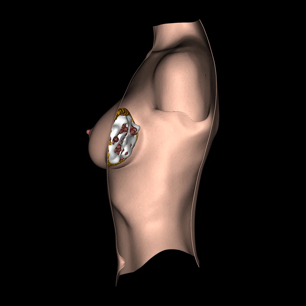 Breast, medial view