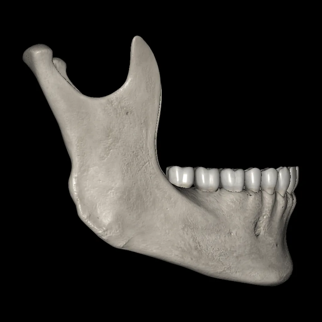 Mandible, lateral view