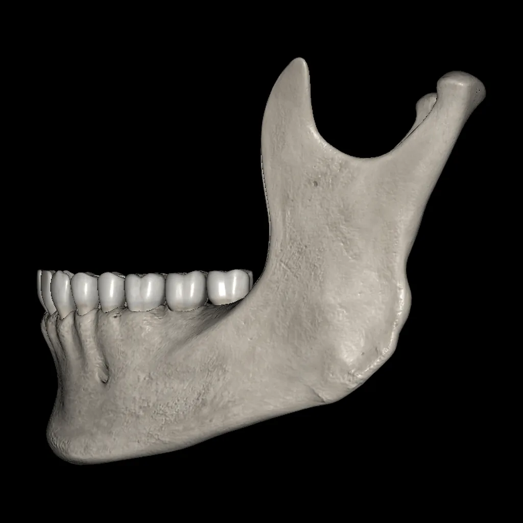Mandible, medial view
