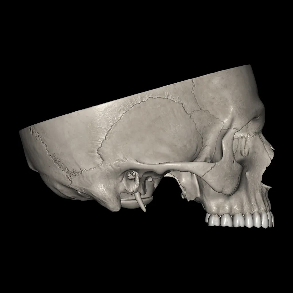 Skull (Cranial base), lateral view