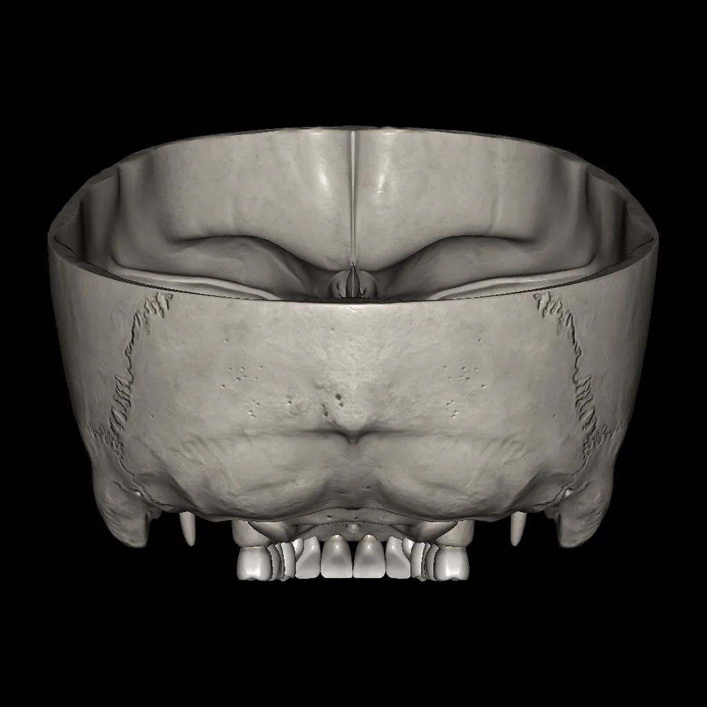 Skull (Cranial base), posterior view